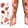 Plaktattoos Geinfecteerde wonden